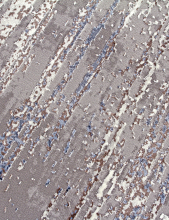 03855A - BLUE / BLUE